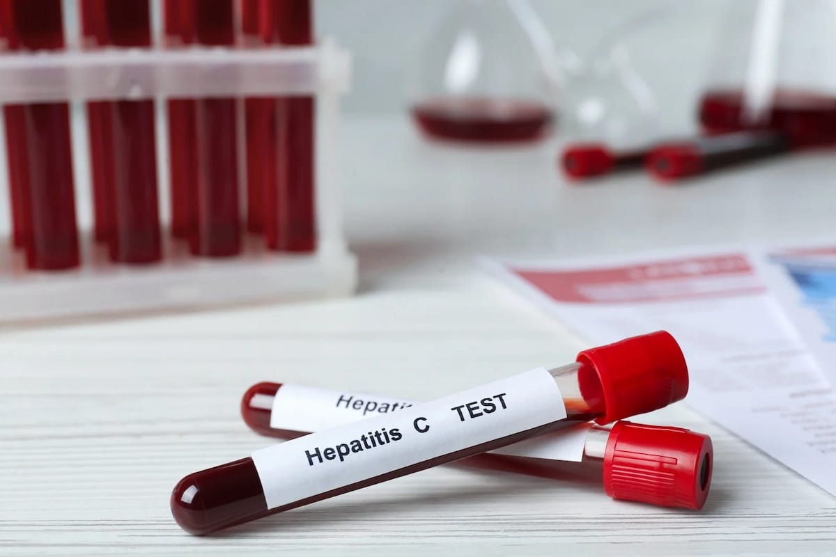 Hepatologist Falls Church